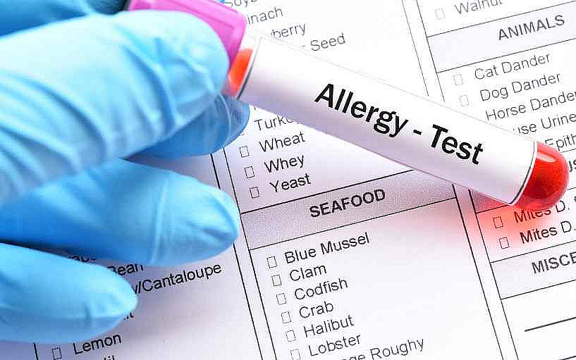 Epidemie alergií