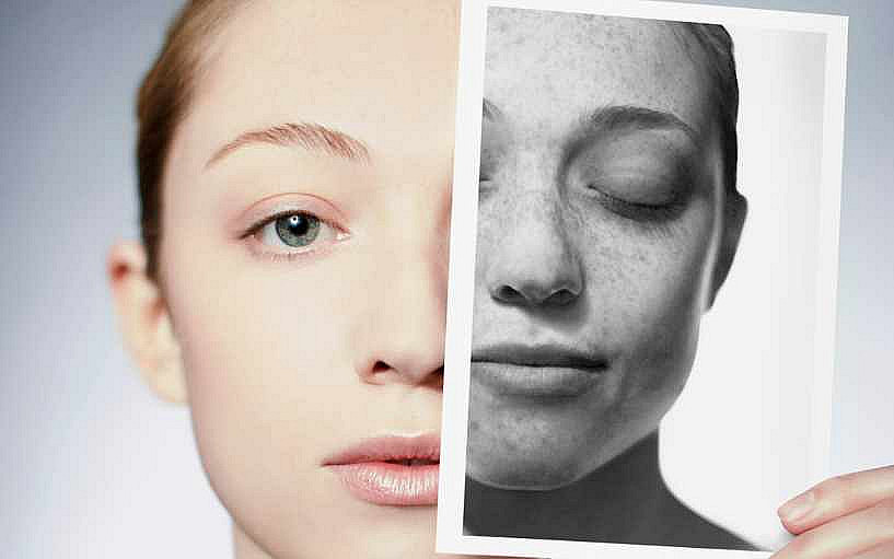 Zdraví kůže 101: základy dermatologie